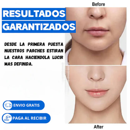 FACE LIFTING PATCH™ Parches 60 PCS 2x1 OFERTA